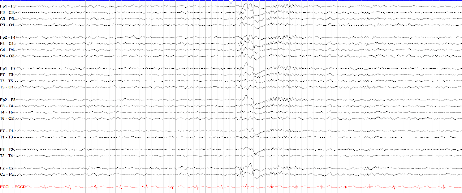 601b2335f6a738628168f529_5e66a